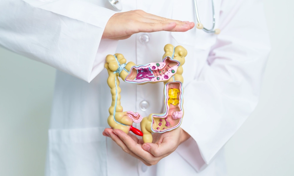 sindromul colonului iritabil ce este cum il recunosti si cum se trateaza