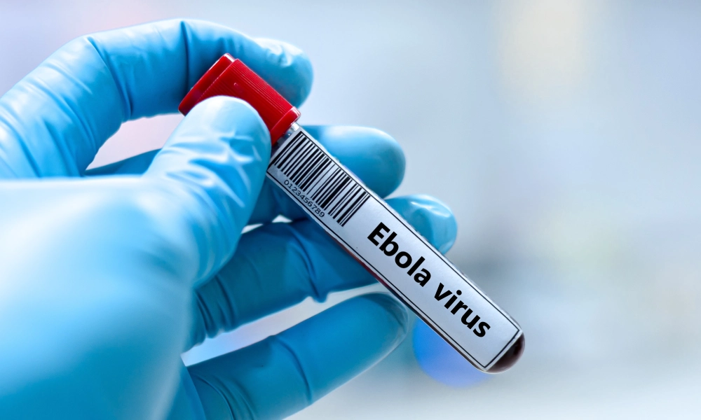 Virusul ebola