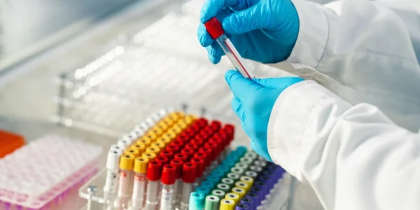 Hemograma completă: ce este, ce analizează și cum se interpretează. Explicații simple pentru leucocite, hemoglobină și alte valori.