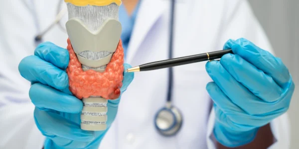 Tiroidita Hashimoto: cauze, simptome, diagnostic și tratament